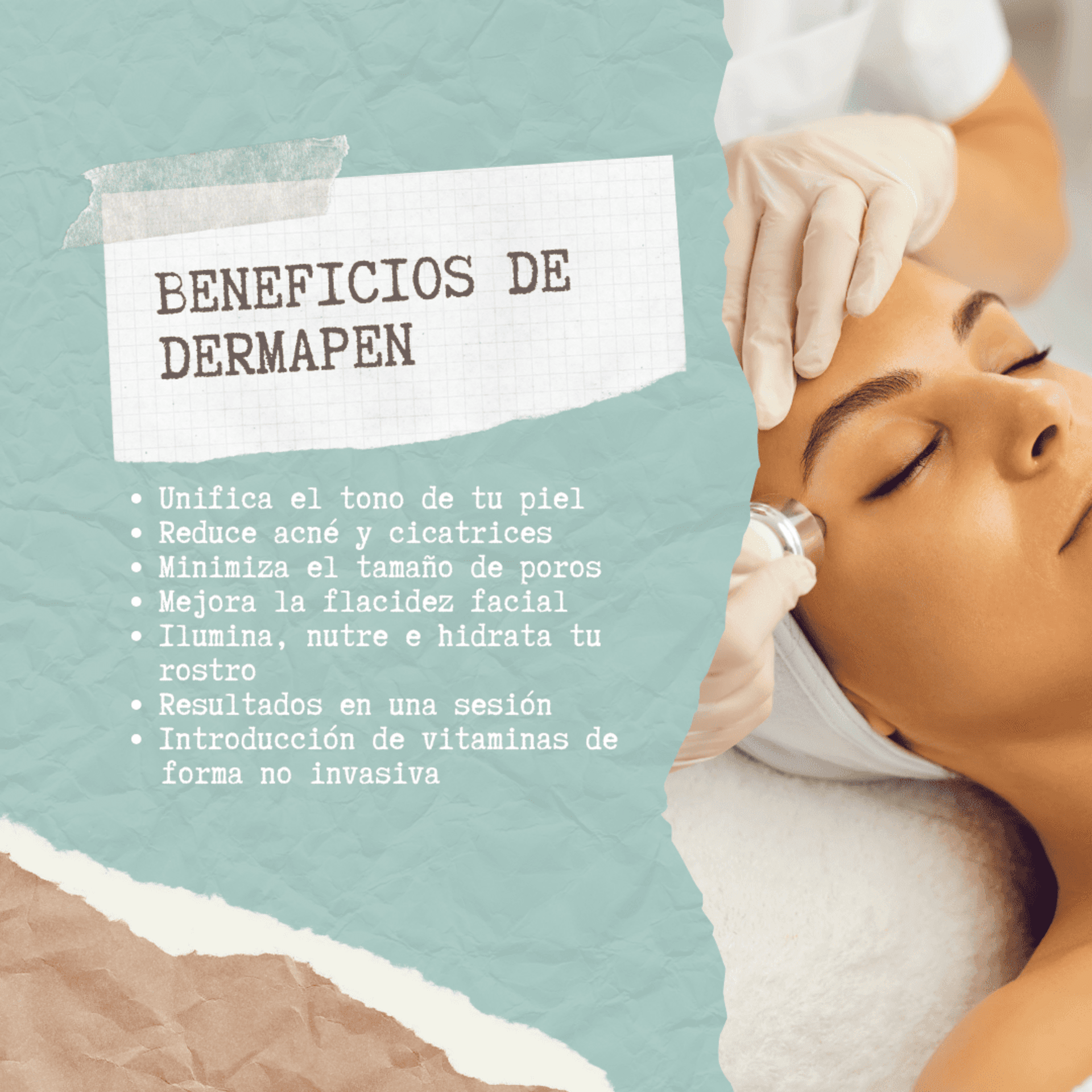 SESIÓN FACIAL CON DERMAPEN - 1